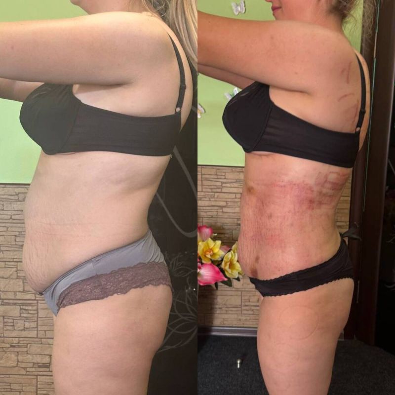 ��� ��������� ���� ��������� � �������: ������� ���������������� ������� � ��������